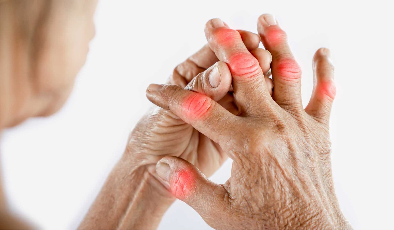 7 Makanan Pemicu Asam Urat yang Harus Anda Hindari